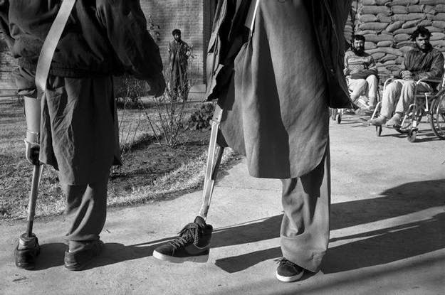 AFGHANISTAN. 1994. Kabul. Trying out artificial limbs at ICRC clinic in Kabul.